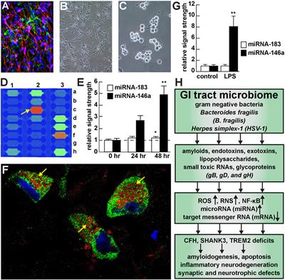 Microbiome-Mediated Upregulation of MicroRNA-146a in Sporadic Alzheimer’s Disease